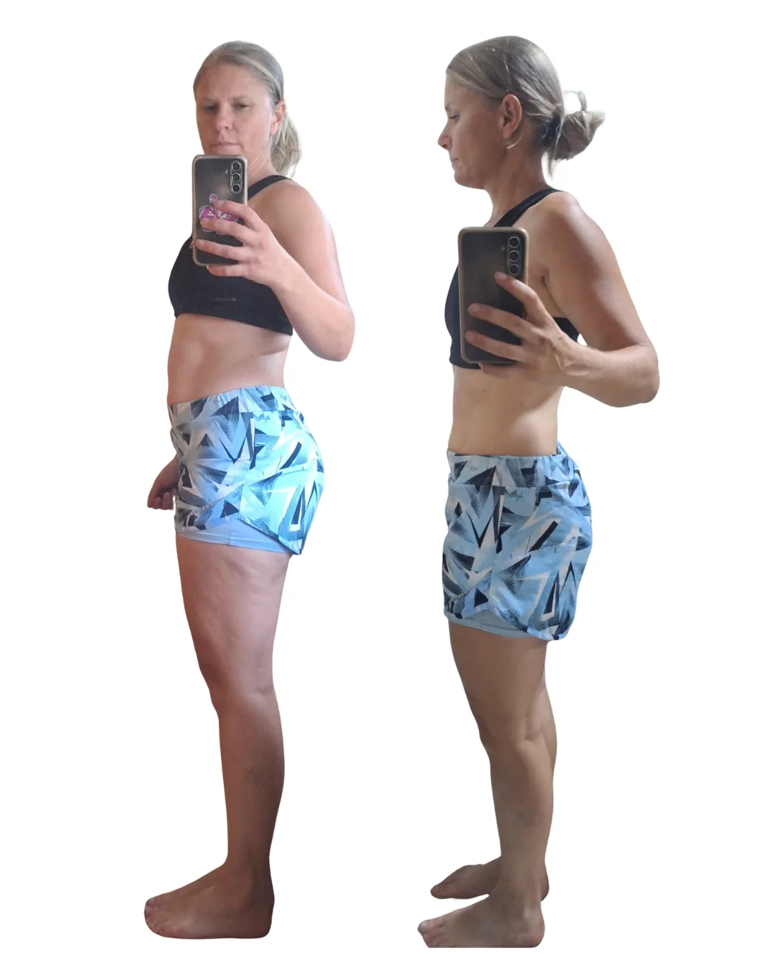 Chantel before and after