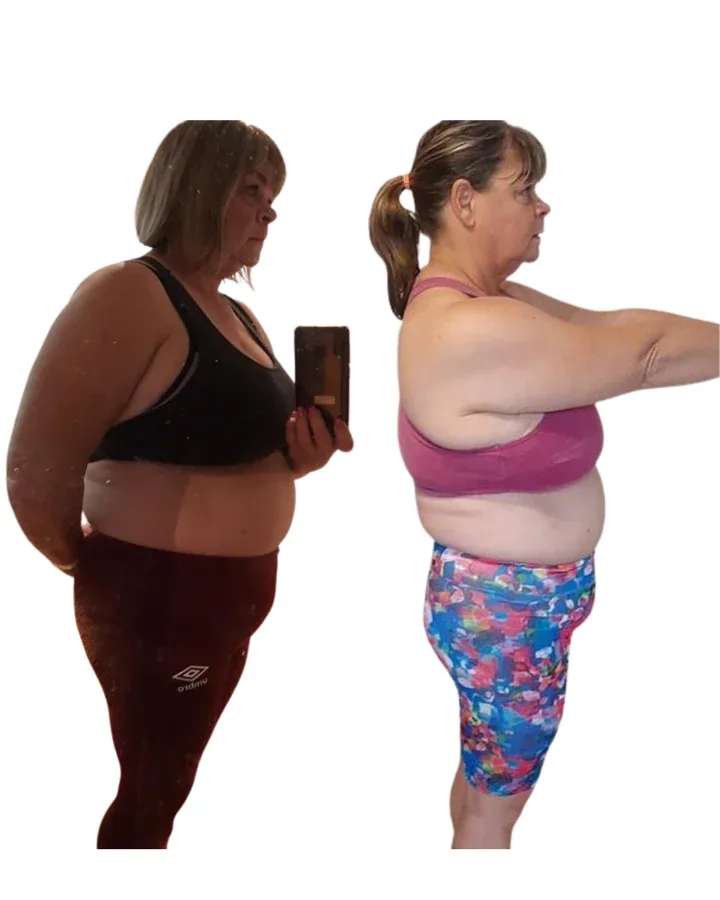 Sandra before and after